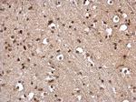 STAT5 alpha Antibody in Immunohistochemistry (Paraffin) (IHC (P))