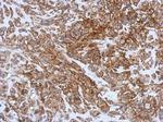 CD99 Antibody in Immunohistochemistry (Paraffin) (IHC (P))