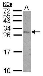 CD99 Antibody in Western Blot (WB)