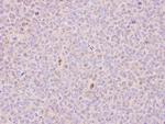 RCC1 Antibody in Immunohistochemistry (Paraffin) (IHC (P))