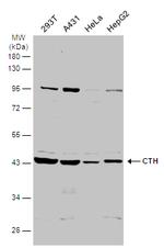 CTH Antibody in Western Blot (WB)