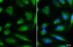 DBT Antibody in Immunocytochemistry (ICC/IF)