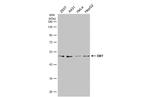 DBT Antibody in Western Blot (WB)