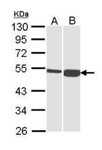 DBT Antibody in Western Blot (WB)