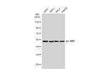 DBT Antibody in Western Blot (WB)