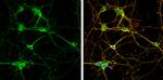 CRMP2 Antibody in Immunocytochemistry (ICC/IF)