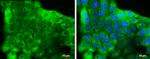 NSE Antibody in Immunocytochemistry (ICC/IF)