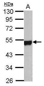 NSE Antibody in Western Blot (WB)