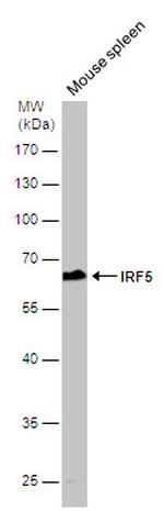 IRF5 Antibody in Western Blot (WB)