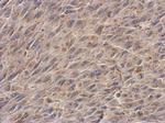 NDUFS3 Antibody in Immunohistochemistry (Paraffin) (IHC (P))