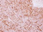 CD73 Antibody in Immunohistochemistry (Paraffin) (IHC (P))