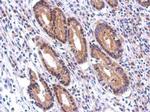 Nectin 2 Antibody in Immunohistochemistry (Paraffin) (IHC (P))