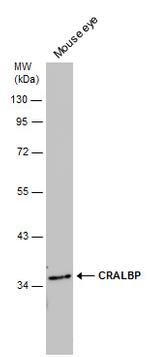 CRALBP Antibody in Western Blot (WB)