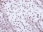 SSB Antibody in Immunohistochemistry (Paraffin) (IHC (P))