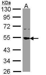 SSB Antibody in Western Blot (WB)