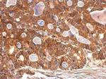 SULT1A1 Antibody in Immunohistochemistry (Paraffin) (IHC (P))