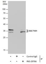 SULT1A1 Antibody in Immunoprecipitation (IP)