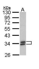 SULT1A1 Antibody in Western Blot (WB)