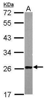 TAGLN Antibody in Western Blot (WB)