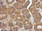 VEGFC Antibody in Immunohistochemistry (Paraffin) (IHC (P))