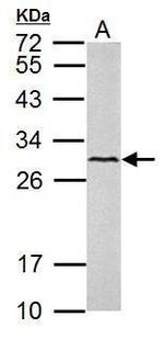 VEGFC Antibody in Western Blot (WB)