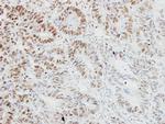 TRAF3IP2 Antibody in Immunohistochemistry (Paraffin) (IHC (P))