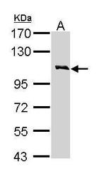 CSF2RB Antibody in Western Blot (WB)