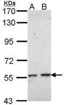 CYP17A1 Antibody in Western Blot (WB)