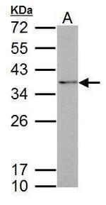 Fibrillarin Antibody in Western Blot (WB)