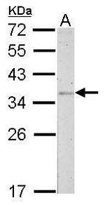 Fibrillarin Antibody in Western Blot (WB)