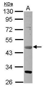 VEGFD Antibody in Western Blot (WB)