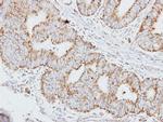 HADHA Antibody in Immunohistochemistry (Paraffin) (IHC (P))