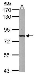 HADHA Antibody in Western Blot (WB)