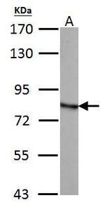 HADHA Antibody in Western Blot (WB)