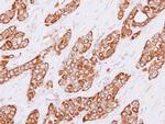 Cytokeratin 4 Antibody in Immunohistochemistry (Paraffin) (IHC (P))