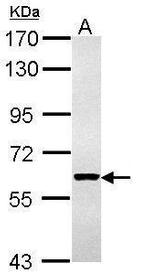 Cytokeratin 4 Antibody in Western Blot (WB)