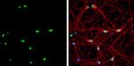 MBNL1 Antibody in Immunocytochemistry (ICC/IF)