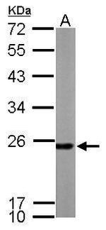 PRDX1 Antibody in Western Blot (WB)