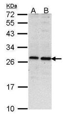 PSMD10 Antibody in Western Blot (WB)