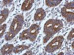 PTK7 Antibody in Immunohistochemistry (Paraffin) (IHC (P))