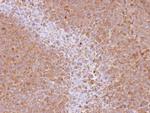 SRC3 Antibody in Immunohistochemistry (Paraffin) (IHC (P))