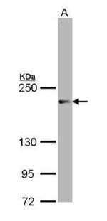 SRC3 Antibody in Western Blot (WB)