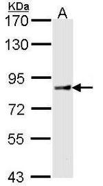 Cullin 4A Antibody in Western Blot (WB)