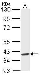 AIP Antibody in Western Blot (WB)