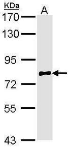 Calpain 10 Antibody in Western Blot (WB)