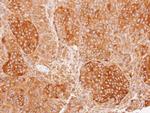 CHP1 Antibody in Immunohistochemistry (Paraffin) (IHC (P))