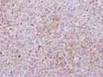 PADI4 Antibody in Immunohistochemistry (Paraffin) (IHC (P))