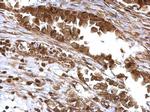 BMI-1 Antibody in Immunohistochemistry (Paraffin) (IHC (P))