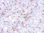CYP27A1 Antibody in Immunohistochemistry (Paraffin) (IHC (P))