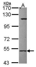 CYP27A1 Antibody in Western Blot (WB)